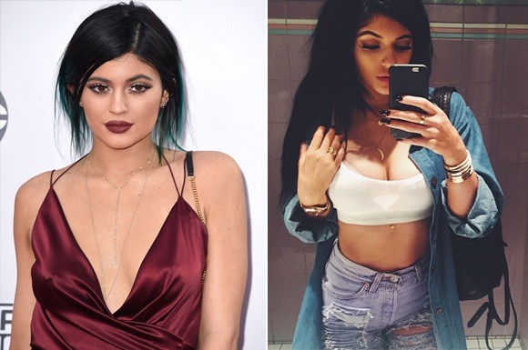 (Una foto de Kylie hace unos meses y otra de esta semana. ¿Notas alguna diferencia?)