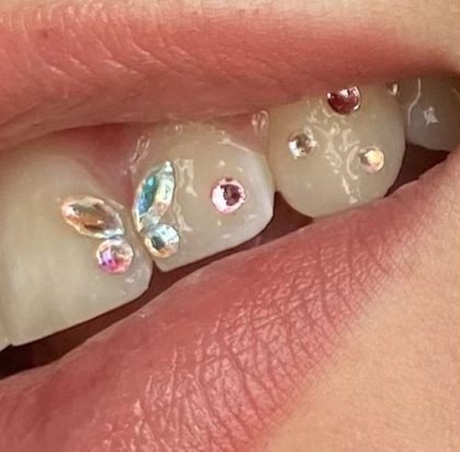 Las tooth gems son la nueva tendencia para tu sonrisa - EstiloDF